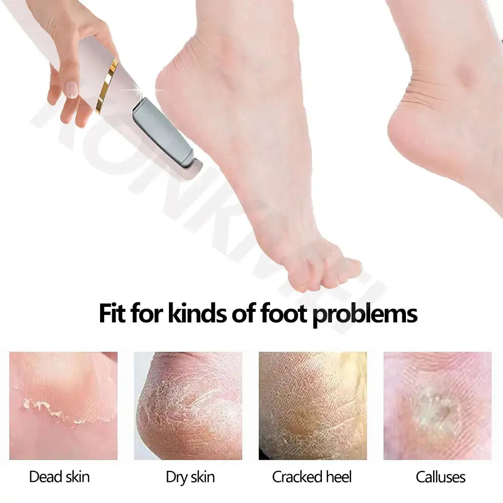 VelvetStep Foot Exfoliator