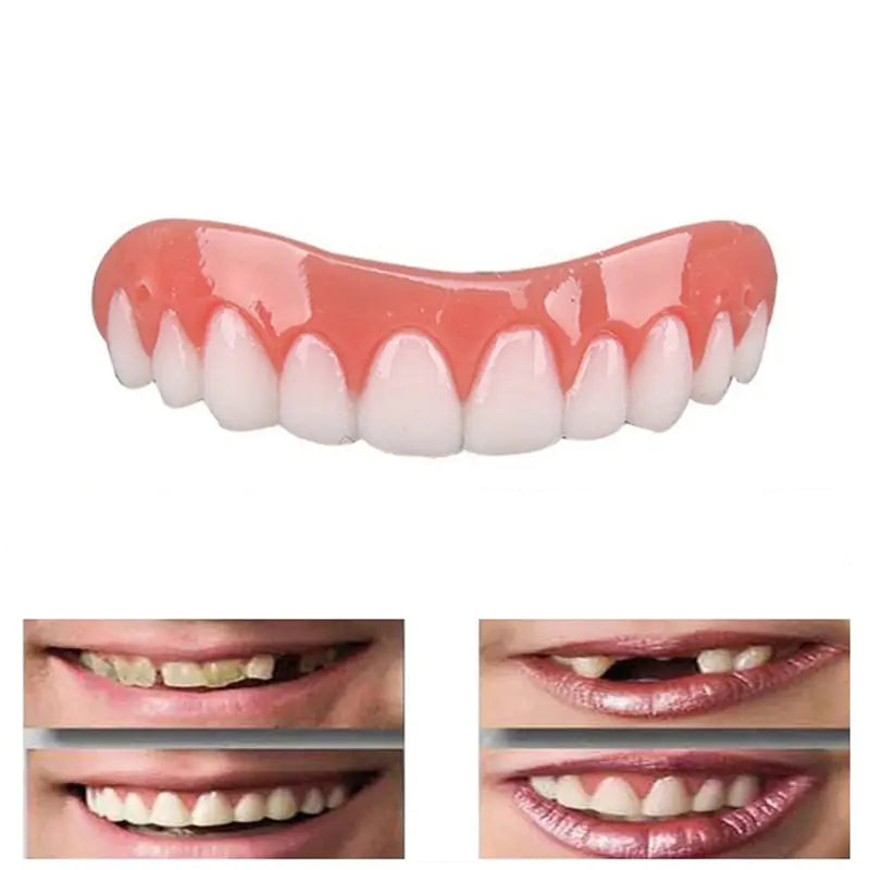 Upper Tooth Perfect Smile Dentures